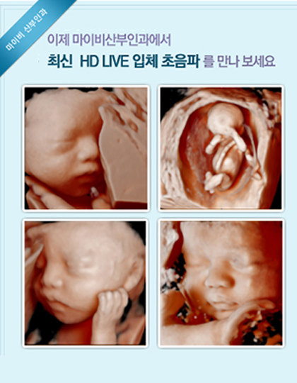 ��õ ���̺����ΰ�������������